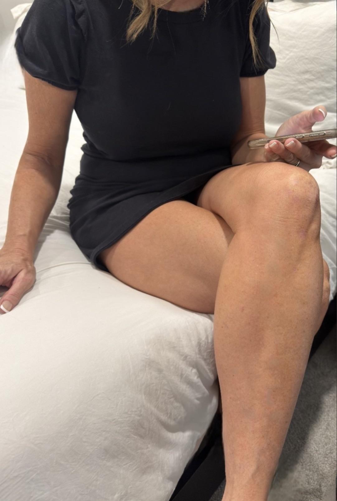 What MILF legs look like